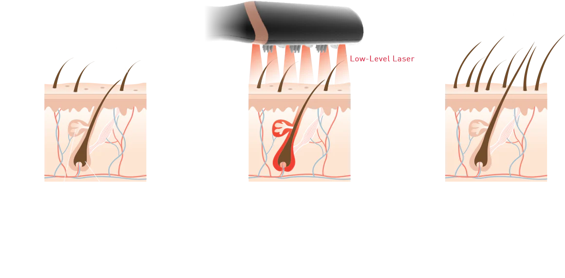 Hair Growth Device