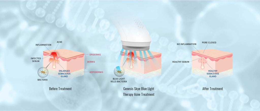 UV Blue Light Device