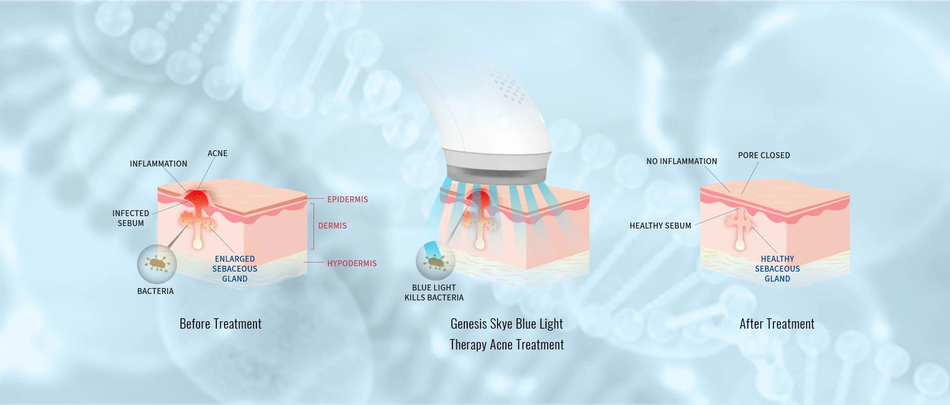 UV Blue Light Device